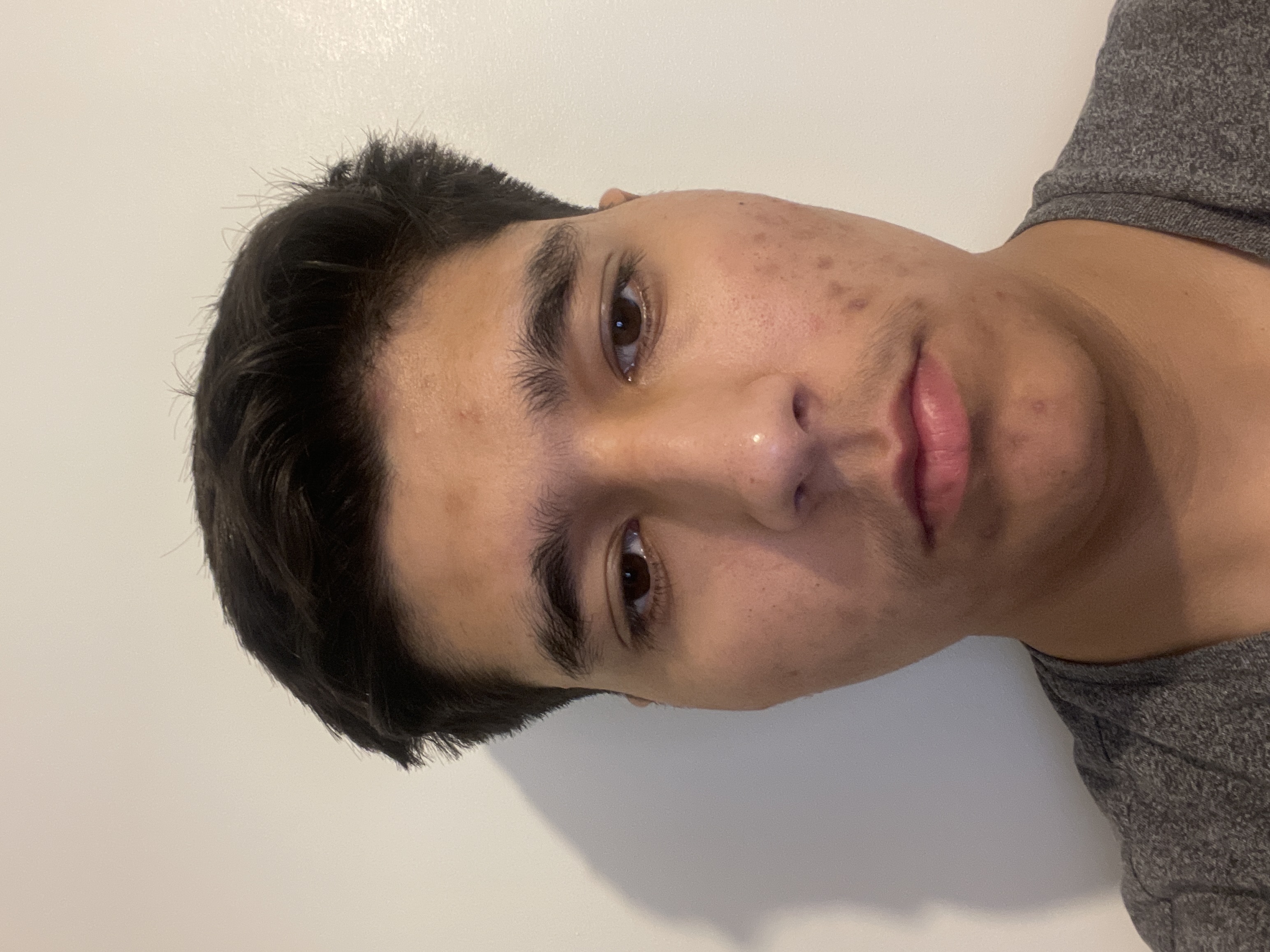 Naz